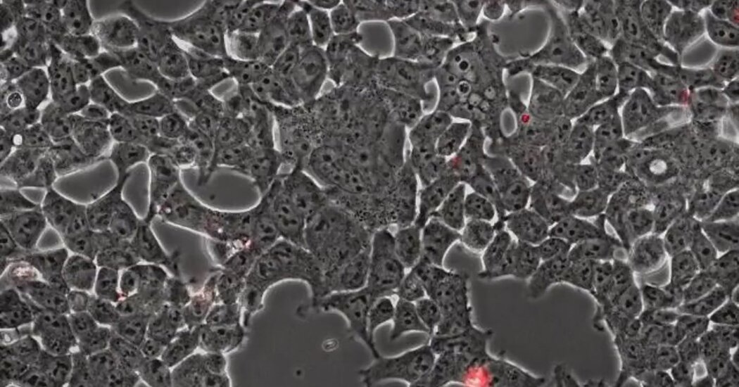 A microscopic video shows the coronavirus on the rampage.